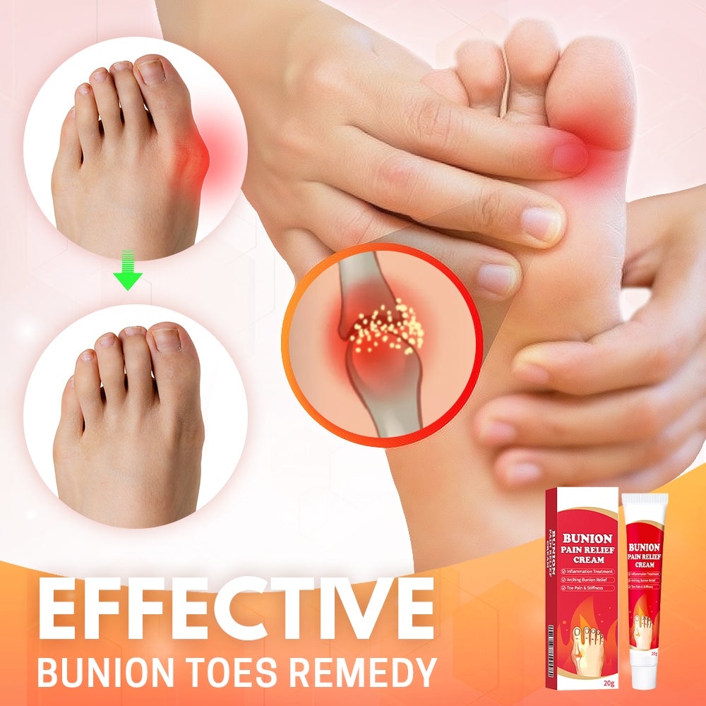 Bunion Toe Relief Cream - Don't Know What To Gift