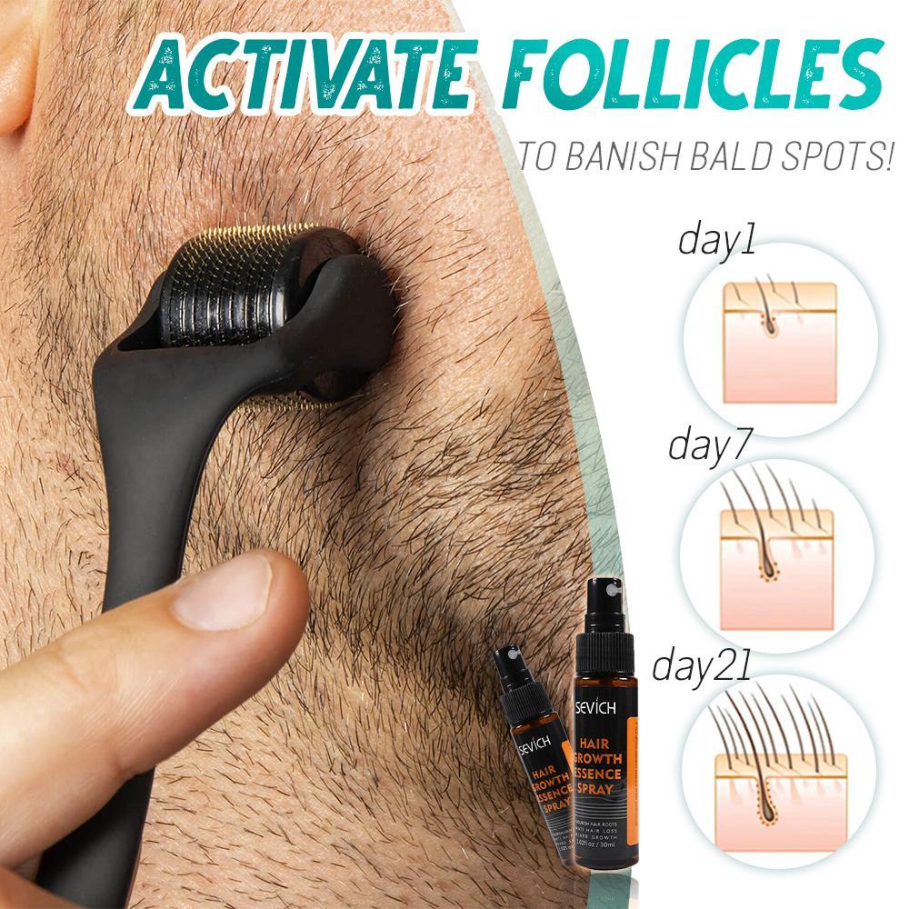 Beard Growth Roller Set - Don't Know What To Gift