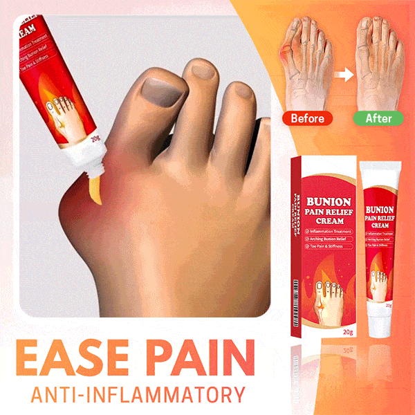 Bunion Toe Relief Cream - Don't Know What To Gift