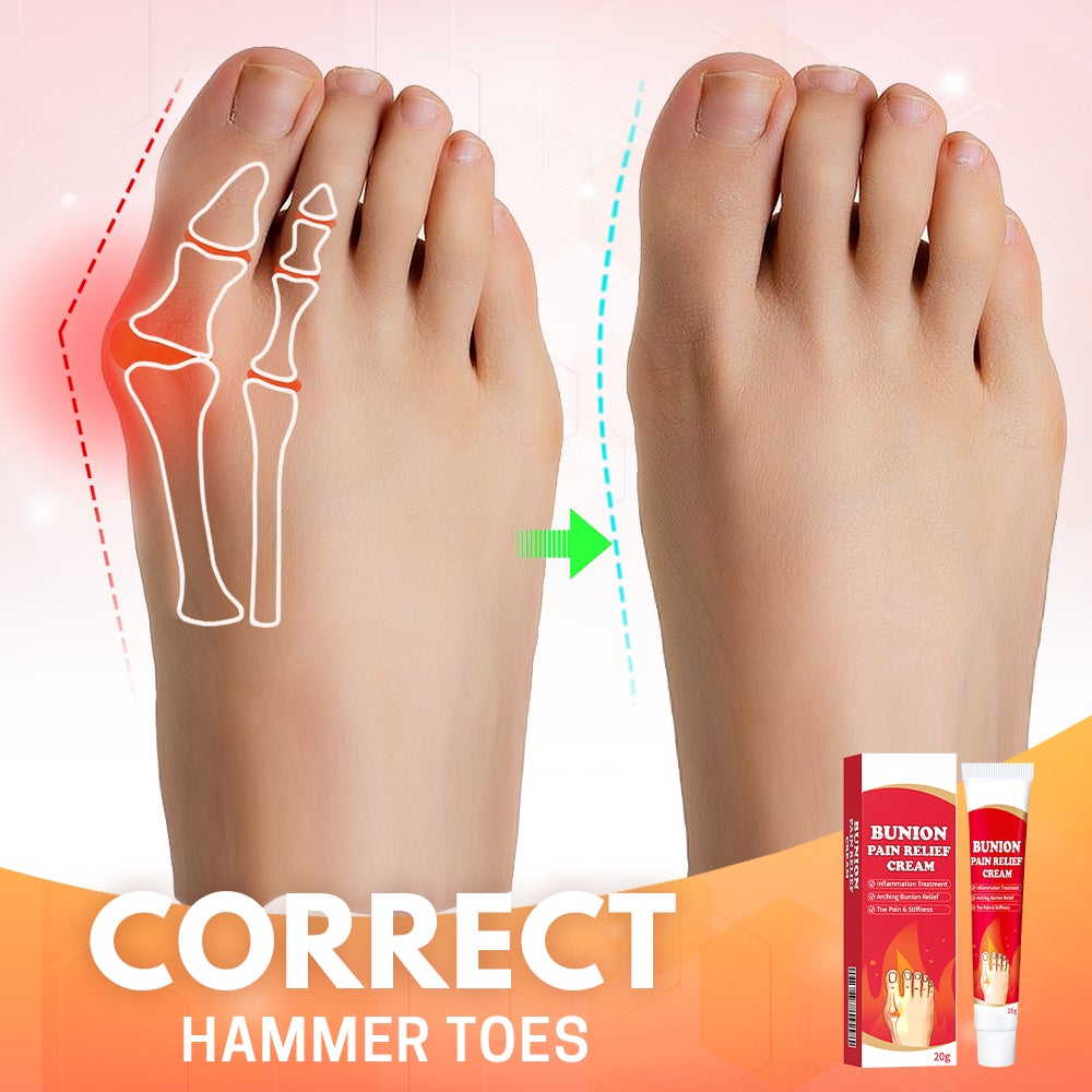 Bunion Toe Relief Cream - Don't Know What To Gift