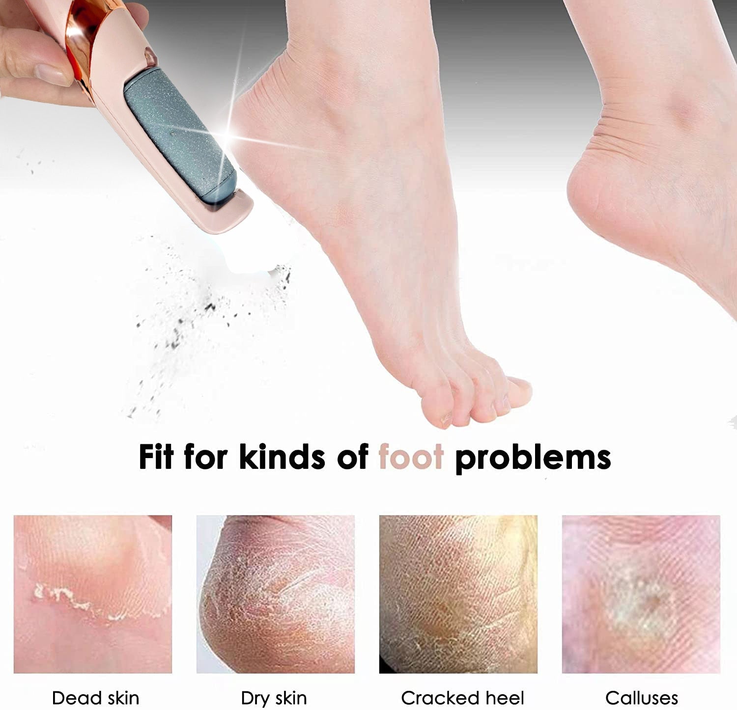 Electric Foot File Callus Remover - Don't Know What To Gift