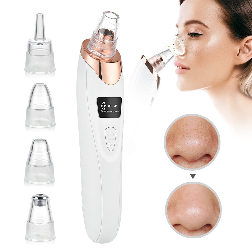 Beauty Electric Blackhead Remover - Don't Know What To Gift