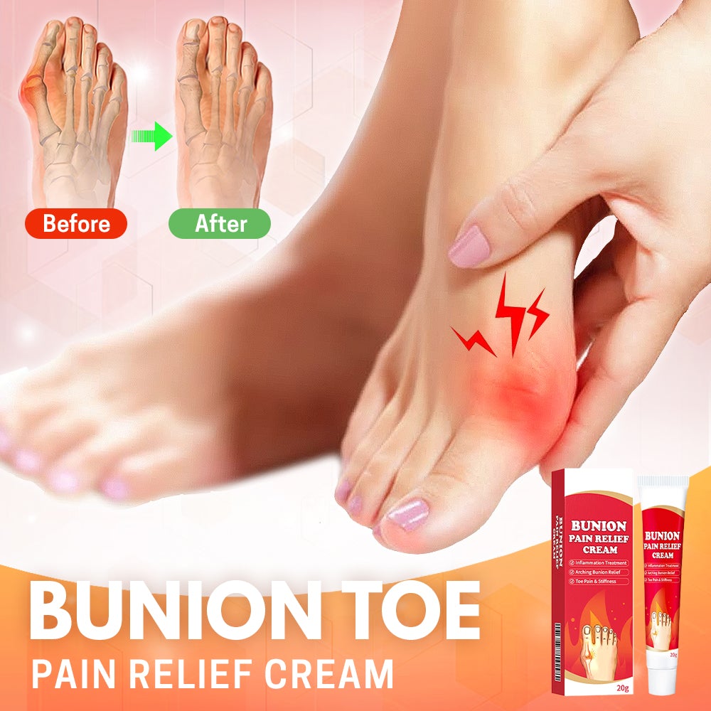 Bunion Toe Relief Cream - Don't Know What To Gift